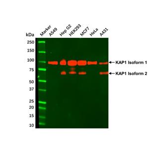aladdin 阿拉丁 Ab111687 KAP1 Mouse mAb mAb(4E1-D12-F8); Mouse anti Human KAP1 Antibody; WB, IHC-F, IHC-P, ICC/IF, IP; Unconjugated