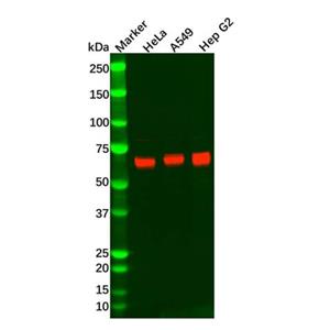 aladdin 阿拉丁 Ab111970 Recombinant Keap1 Antibody Recombinant (R02-1H7); Rabbit anti Human Keap1 Antibody; WB, IHC; Unconjugated