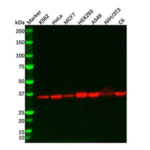aladdin 阿拉丁 Ab112519 Recombinant Lactate Dehydrogenase Antibody Recombinant (R06-6J2); Rabbit anti Human Lactate Dehydrogenase Antibody; WB, IHC, ICC, IF; Unconjugated