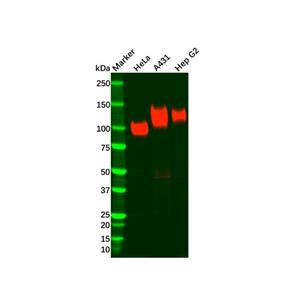 aladdin 阿拉丁 Ab112727 Recombinant LAMP1 Antibody Recombinant (R05-7D4); Rabbit anti Human LAMP1 Antibody; WB, IHC; Unconjugated