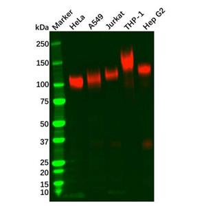 aladdin 阿拉丁 Ab112746 Recombinant LAMP2 Antibody Recombinant (R03-0B5); Rabbit anti Human LAMP2 Antibody; WB, IHC; Unconjugated