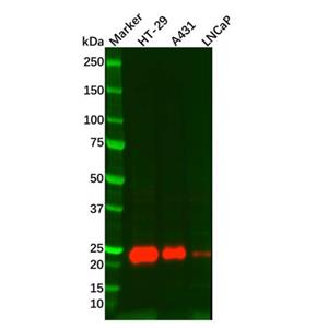 aladdin 阿拉丁 Ab113231 Lipocalin-2/NGAL Mouse mAb mAb (J13); Mouse anti Human Lipocalin-2/NGAL Antibody; WB; Unconjugated