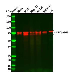 aladdin 阿拉丁 Ab113812 Recombinant LYRIC/AEG1 Antibody Recombinant (R05-5G3); Rabbit anti Human LYRIC/AEG1 Antibody; WB, IHC, ICC, IF; Unconjugated