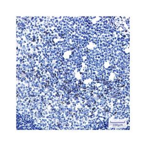 Recombinant LYRIC/AEG1 Antibody,Recombinant LYRIC/AEG1 Antibody