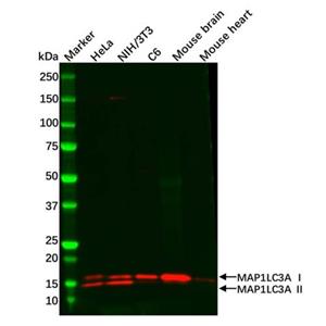 aladdin 阿拉丁 Ab114168 Recombinant MAP1LC3A Antibody Recombinant (R07-9B1); Rabbit anti Human MAP1LC3A Antibody; WB, IHC; Unconjugated
