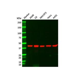 aladdin 阿拉丁 Ab114854 Recombinant MEK1 Antibody Recombinant (R07-8C5); Rabbit anti Human MEK1 Antibody; WB; Unconjugated