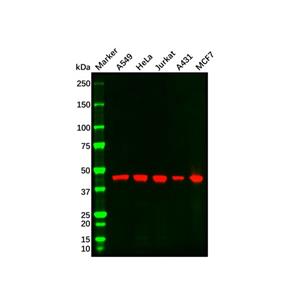 aladdin 阿拉丁 Ab114868 Recombinant MEK2 Antibody Recombinant (R05-2G7); Rabbit anti Human MEK2 Antibody; WB, IHC, ICC, IF; Unconjugated