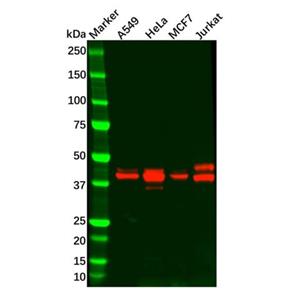 aladdin 阿拉丁 Ab115495 Recombinant MAPKAPK3 Antibody Recombinant (R08-4B6); Rabbit anti Human MAPKAPK3 Antibody; WB; Unconjugated
