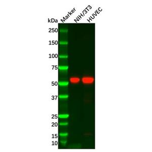 aladdin 阿拉丁 Ab115644 Recombinant MMP14 Antibody Recombinant (R05-6H5); Rabbit anti Human MMP14 Antibody; WB, IHC; Unconjugated