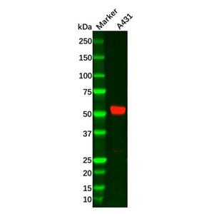 Recombinant MMP14 Antibody,Recombinant MMP14 Antibody