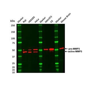 aladdin 阿拉丁 Ab115686 Recombinant MMP3 Antibody Recombinant (R04-8G6); Rabbit anti Human MMP3 Antibody; WB, IHC; Unconjugated