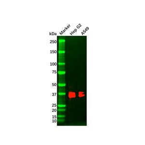 aladdin 阿拉丁 Ab116122 MSI2 Mouse mAb mAb(2C11); Mouse anti Human MSI2 Antibody; WB, IHC, ELISA; Unconjugated