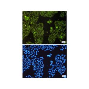 Recombinant MTCO2 Antibody,Recombinant MTCO2 Antibody