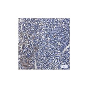 Recombinant MTCO2 Antibody,Recombinant MTCO2 Antibody