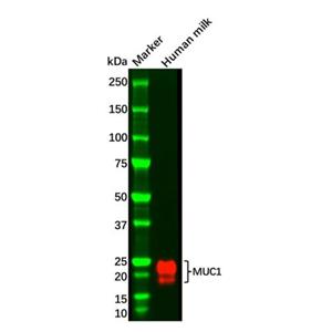 MUC1 Mouse mAb,MUC1 Mouse mAb