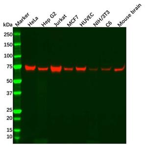 aladdin 阿拉丁 Ab117821 Recombinant NF2/Merlin Antibody Recombinant (R07-1A6); Rabbit anti Human NF2/Merlin Antibody; WB; Unconjugated
