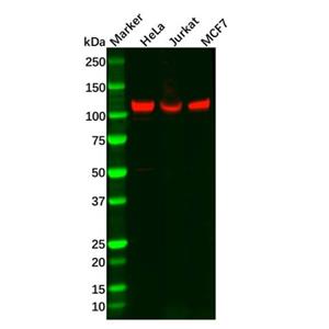 Recombinant NFkB p100/NFKB2 Antibody,Recombinant NFkB p100/NFKB2 Antibody