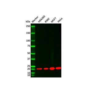 aladdin 阿拉丁 Ab118705 Recombinant NRAS Antibody Recombinant (R01-7D0); Rabbit anti Human NRAS Antibody; WB; Unconjugated