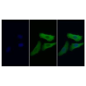 CD8 alpha Mouse mAb,NSE Mouse mAb