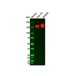 aladdin 阿拉丁 Ab119577 Recombinant P Glycoprotein Antibody Recombinant (R02-6B2); Rabbit anti Human P Glycoprotein Antibody; WB; Unconjugated