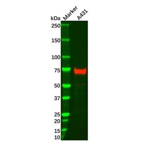 aladdin 阿拉丁 Ab119899 p63 Mouse mAb mAb (D2); Mouse anti Human p63 Antibody; WB; Unconjugated