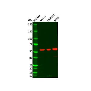 aladdin 阿拉丁 Ab119916 Recombinant P70 S6 Kinase beta/SRK Antibody Recombinant (R04-9C1); Rabbit anti Human P70 S6 Kinase beta/SRK Antibody; WB, IHC, ICC, IF; Unconjugated