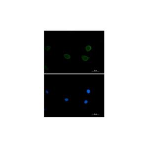 Recombinant P70 S6 Kinase beta/SRK Antibody,Recombinant P70 S6 Kinase beta/SRK Antibody