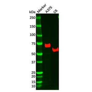 aladdin 阿拉丁 Ab119935 Recombinant NGFR Antibody Recombinant (R05-7D3); Rabbit anti Human NGFR Antibody; WB, IHC; Unconjugated