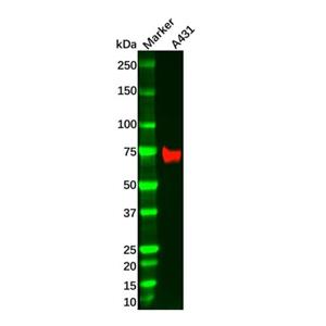 Recombinant NGFR Antibody,Recombinant NGFR Antibody