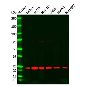 aladdin 阿拉丁 Ab120346 PARK7 Antibody pAb; Rabbit anti Human PARK7 Antibody; WB, IHC; Unconjugated