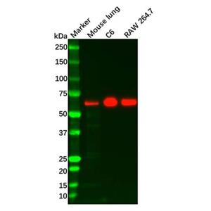 aladdin 阿拉丁 Ab120531 Recombinant Paxillin Antibody Recombinant (R04-3C3); Rabbit anti Human Paxillin Antibody; WB, IHC, ICC, IF; Unconjugated