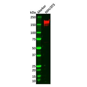 Recombinant PDGFR beta Antibody,Recombinant PDGFR beta Antibody