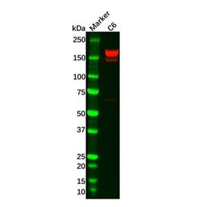 Recombinant PDGFR beta Antibody,Recombinant PDGFR beta Antibody