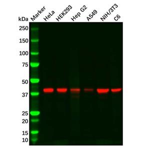 aladdin 阿拉丁 Ab120952 PDHA1 Mouse mAb mAb (3H2-F8-B5); Mouse anti Human PDHA1 Antibody; WB, ICC, IF; Unconjugated