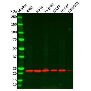 aladdin 阿拉丁 Ab121322 Recombinant Peroxiredoxin 2/PRP Antibody Recombinant (R02-1G5); Rabbit anti Human Peroxiredoxin 2/PRP Antibody; WB, IHC; Unconjugated