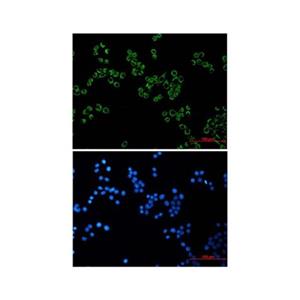 Recombinant Peroxiredoxin 3/PRDX3 Antibody,Recombinant Peroxiredoxin 3/PRDX3 Antibody