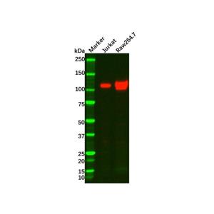 aladdin 阿拉丁 Ab121760 Recombinant PI 3 Kinase p110 delta Antibody Recombinant (R06-7A9); Rabbit anti Human PI 3 Kinase p110 delta Antibody; WB; Unconjugated