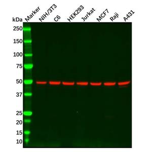 aladdin 阿拉丁 Ab121763 Recombinant PI 3 Kinase p55 gamma Antibody Recombinant (R08-4G4); Rabbit anti Human PI 3 Kinase p55 gamma Antibody; WB; Unconjugated