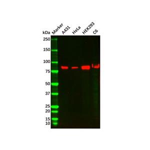 aladdin 阿拉丁 Ab121783 Recombinant PI 3 Kinase p85 beta Antibody Recombinant (R06-5H3); Rabbit anti Human PIK3R2 Antibody; WB, IHC; Unconjugated