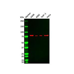 aladdin 阿拉丁 Ab122050 Recombinant PKC beta 2 Antibody Recombinant (R06-0C2); Rabbit anti Human PKC beta 2 Antibody; WB, IHC, ICC, IF; Unconjugated