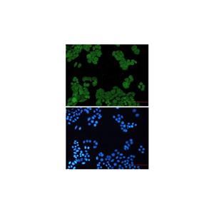 Recombinant PP2A alpha/beta Antibody,Recombinant PP2A alpha/beta Antibody