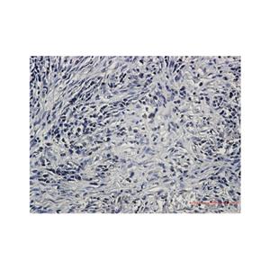 Recombinant PP2A alpha/beta Antibody,Recombinant PP2A alpha/beta Antibody