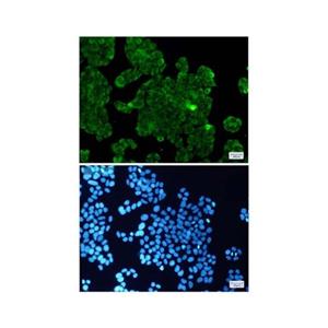 Recombinant PPP1CB Antibody,Recombinant PPP1CB Antibody