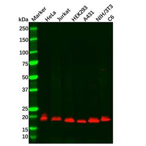 aladdin 阿拉丁 Ab123023 Recombinant Presenilin 1/PS-1 Antibody Recombinant (R05-4D4); Rabbit anti Human Presenilin 1/PS-1 Antibody; WB, IF, ICC; Unconjugated