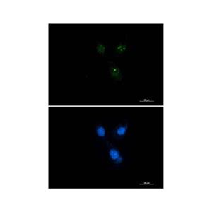 Recombinant Presenilin 1/PS-1 Antibody,Recombinant Presenilin 1/PS-1 Antibody