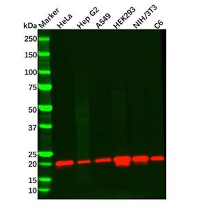 aladdin 阿拉丁 Ab123032 Recombinant Presenilin 2/AD5 Antibody Recombinant (R02-5B8); Rabbit anti Human Presenilin 2/AD5 Antibody; WB; Unconjugated