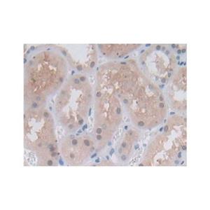 Proteasome 20S beta 6 Antibody,Proteasome 20S beta 6 Antibody