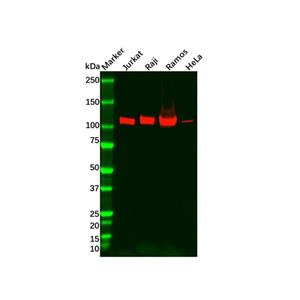 aladdin 阿拉丁 Ab124023 Recombinant PYK2 Antibody Recombinant (R05-5E6); Rabbit anti Human PTK2B Antibody; WB, IHC; Unconjugated