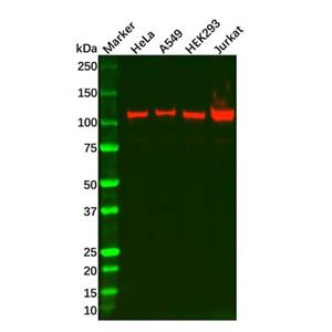 Recombinant RIG-I/DDX58 Antibody,Recombinant RIG-I/DDX58 Antibody