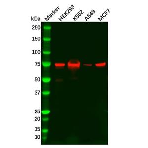 aladdin 阿拉丁 Ab125400 Recombinant RIP Antibody Recombinant (R07-8K8); Rabbit anti Human RIP Antibody; WB; Unconjugated